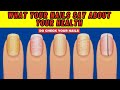 What your nails say about your health  what nails say about your health