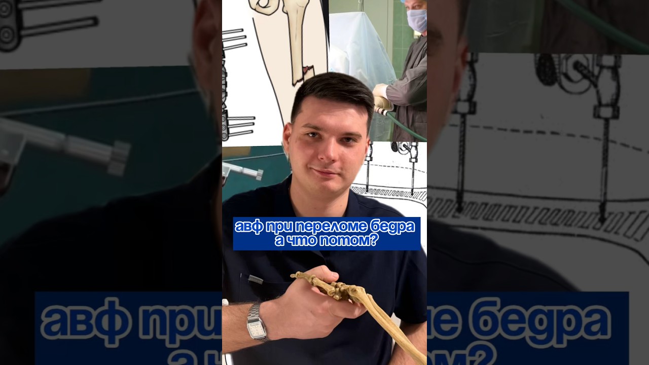 АВФ при переломе бедра! А что дальше ? 