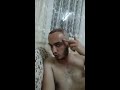 Download saç ekimi sonrası part 1 (Fue Yöntemi ile saç ektiren biri) saç ekimi sonrası part 1 (Fue Yöntemi ile saç ektiren biri)