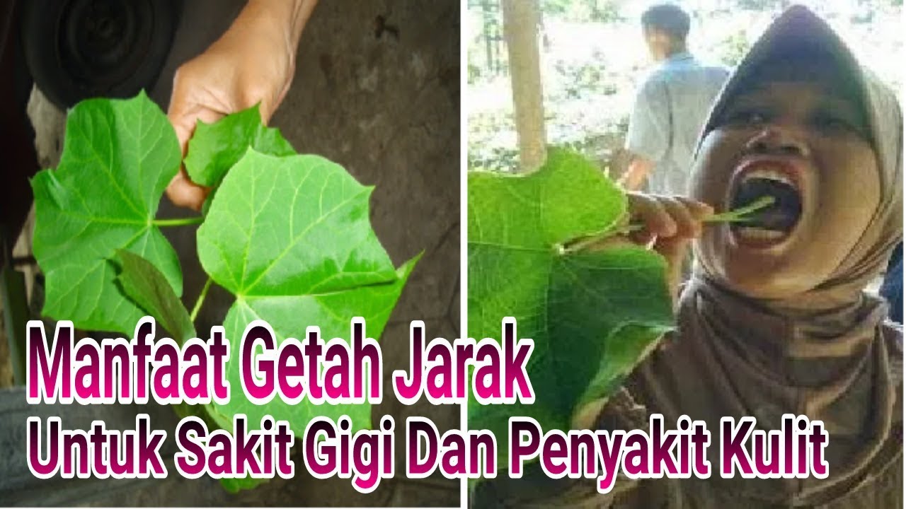 Manfaat Getah  Jarak Untuk  Sakit  Gigi  Dan Penyakit Kulit 