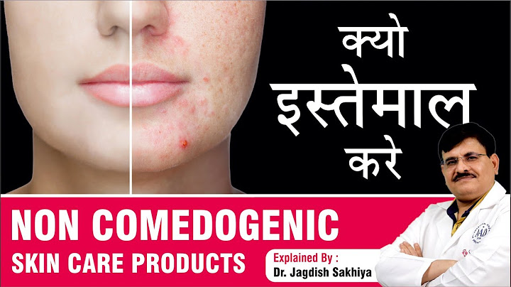 Best non comedogenic moisturizer for acne prone skin