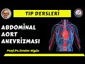Anevrizmalar, Abdominal Aort Anevrizmaları, Prof.Dr. Serdar Akgün, Serdar Akgün Tıp Videoları