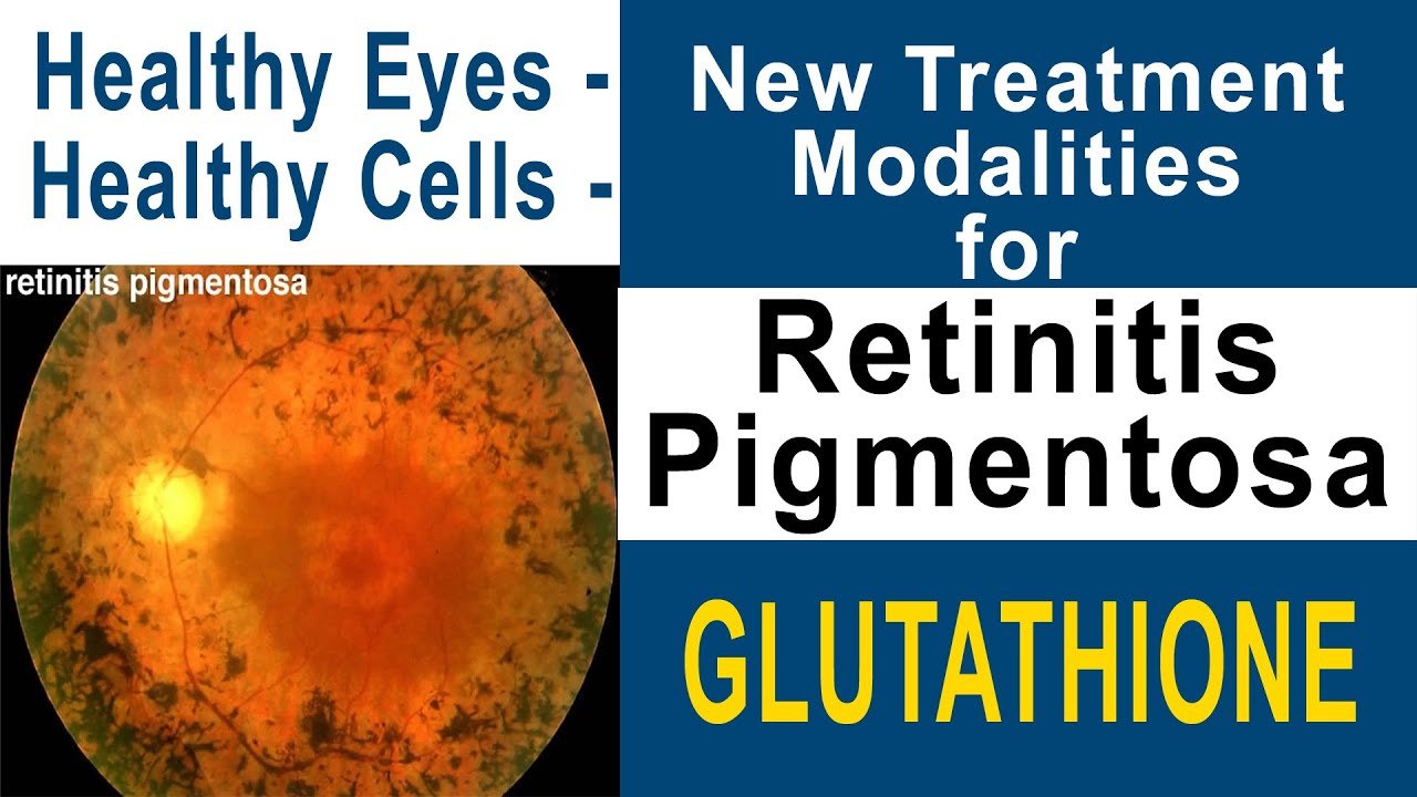 Healthy Eyes - Healthy Cells