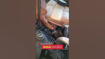 هاكيفاش تعرف بلي عندك مشكل جوان كيلاس 