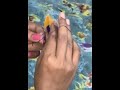twisting needles