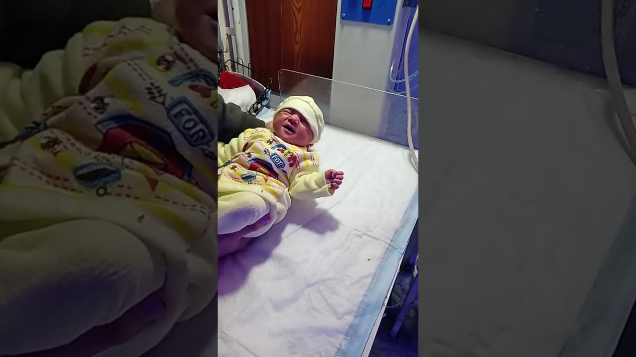 Mashallah! Baby after physiotherapy session 💖Baby recovery progress after physiotherapy 