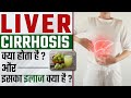 लीवर सिरोसिस क्या होता है ? और इसका इलाज क्या है ? | Liver Damage Causes, Symptoms and Treatment