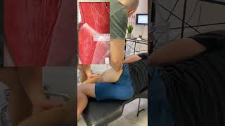 Hip Bursitis Get this nerve checked out first