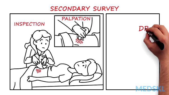 General Surgery  Abdominal Injuries: By Stephanie ...