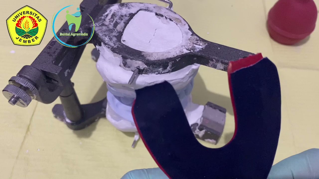 Occlusal Adjustment_Video Pembelajaran 2021 FKG UNEJ