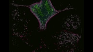 Are you ready to save your cells (Mitosis under 3D microscope)