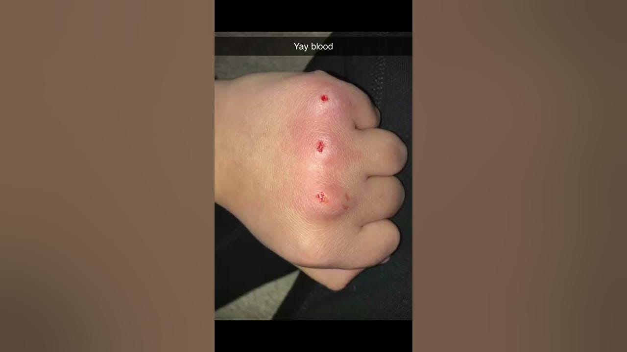Y’all I tried the bloody knuckle game