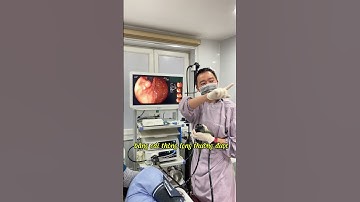 Chỉ định can thiệp u dưới niêm mạc dạ dày.