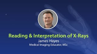 Reading X-Rays Webinar - James Hayes