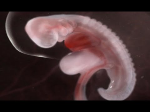 The Embryo from Implantation to 4 Weeks