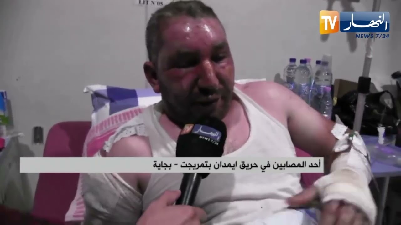 بجاية: النهار ترصد وضعية المصابين في حريق منطقة ايمدان بمستشفى خراطة