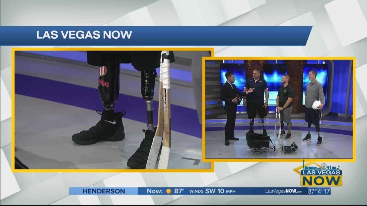 POP has changed the lives of those who have lost limbs