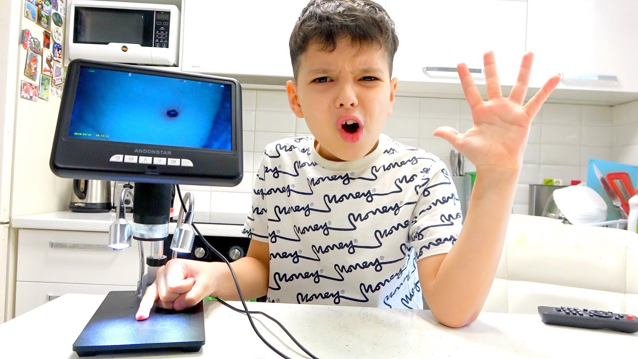 What does Yegorka have on her hands? Microbes?Что у Егорки на Руках???