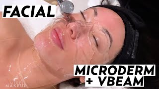 Getting a Facial with Microdermabrasion \& VBeam Laser with Vanessa Hernandez! | Skincare Susan Yara