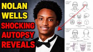Nolan's Autopsy Had Missing Body Parts. Expert Shows What That Means for the Investigation.