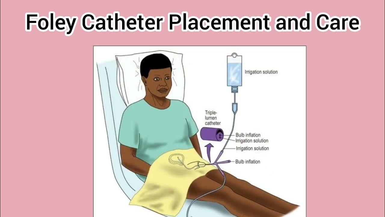 Foley Catheter Placement And Care How Do I Care For My Catheter And foley-catheter-placement-and-care-how-do-i-care-for-my-catheter-and
