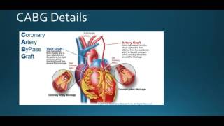 Famous CABG coding BC3020-Week 5 Wealth