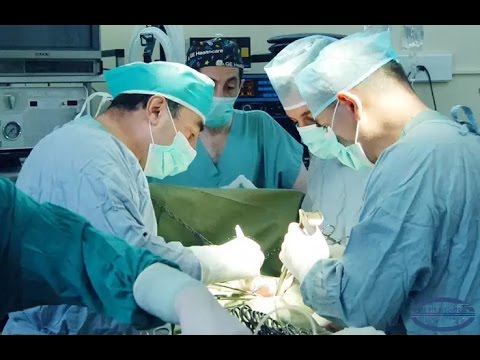 Laparoscopic Appendectomy Youtube