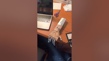 Arduino Prosthetic Hand