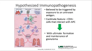 UAB Dr. Maria Acosta Lara - Sarcoidosis Outreach June 2017