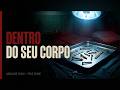 Eles Implantaram Parafusos que Enferrujam no Corpo. O Cirurgião Recebia Propina.