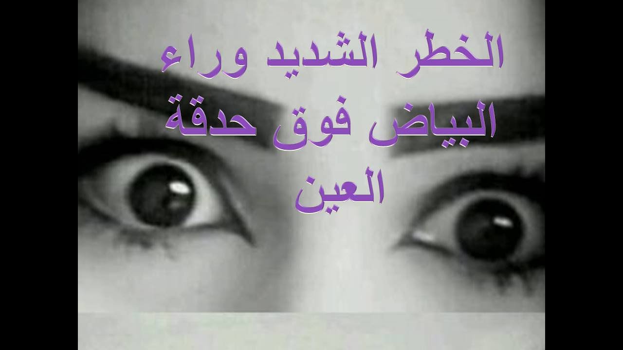 خطورة البياض الموجود أعلى الحدقة فى العين / إصنع حلمك / تفاصيل خطيرة (10) .