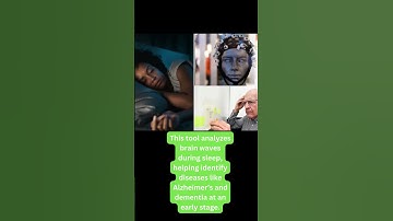 “AI Can Detect Memory Loss Before It Happens! 😲 | Early Alzheimer& Dementia Detection” #aifacts #ai