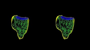 Network of internal filaments in a dendritic spine.