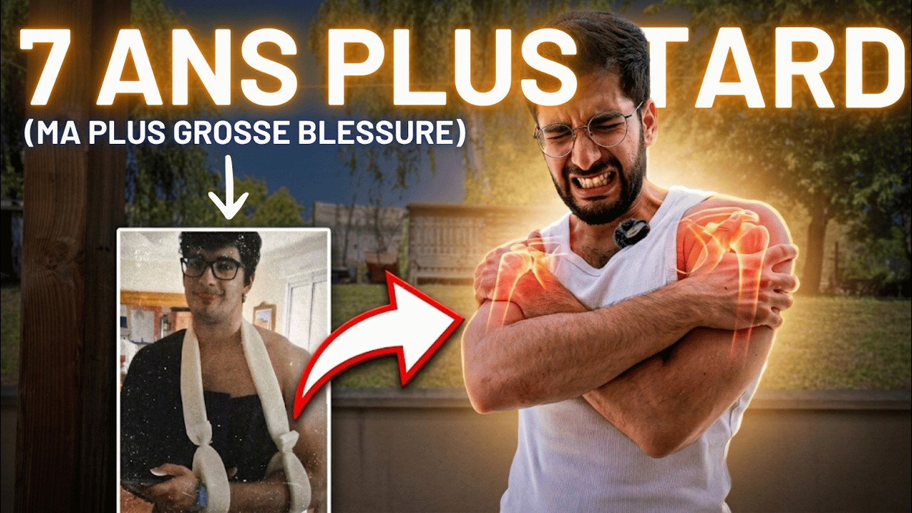 Je me suis déboité les 2 épaules en même temps. Bilan 7 ans plus tard.