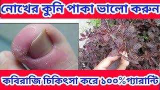 নোখের কুনি পাকা ভালো করুন ভেজস ও কবিরাজি চিকিৎসা করে ১০০%গ্যারান্টি।Bangla health tips. screenshot 2
