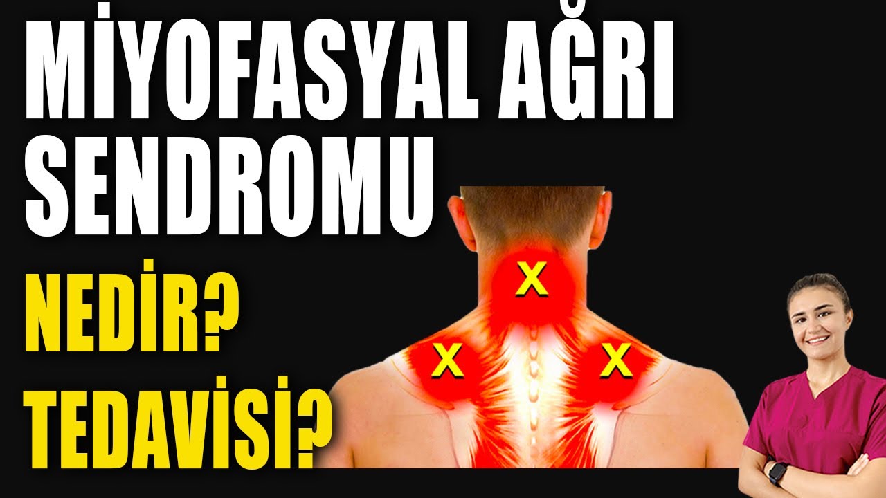 MİYOFASYAL AĞRI SENDROMU #aktifizyo #kulunçağrısı #boyunağrısı #fiziktedavi