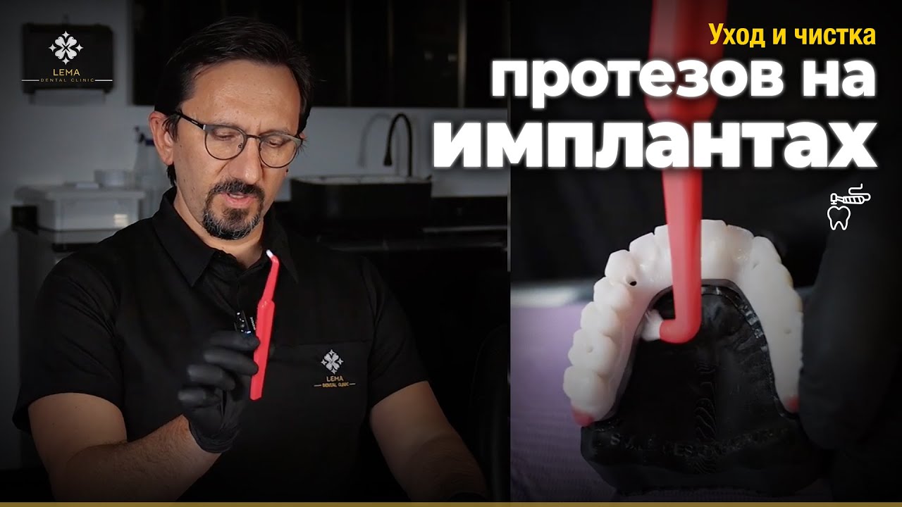 🤍 Руководство по уходу за титановыми балочными имплантатами для здоровой улыбки