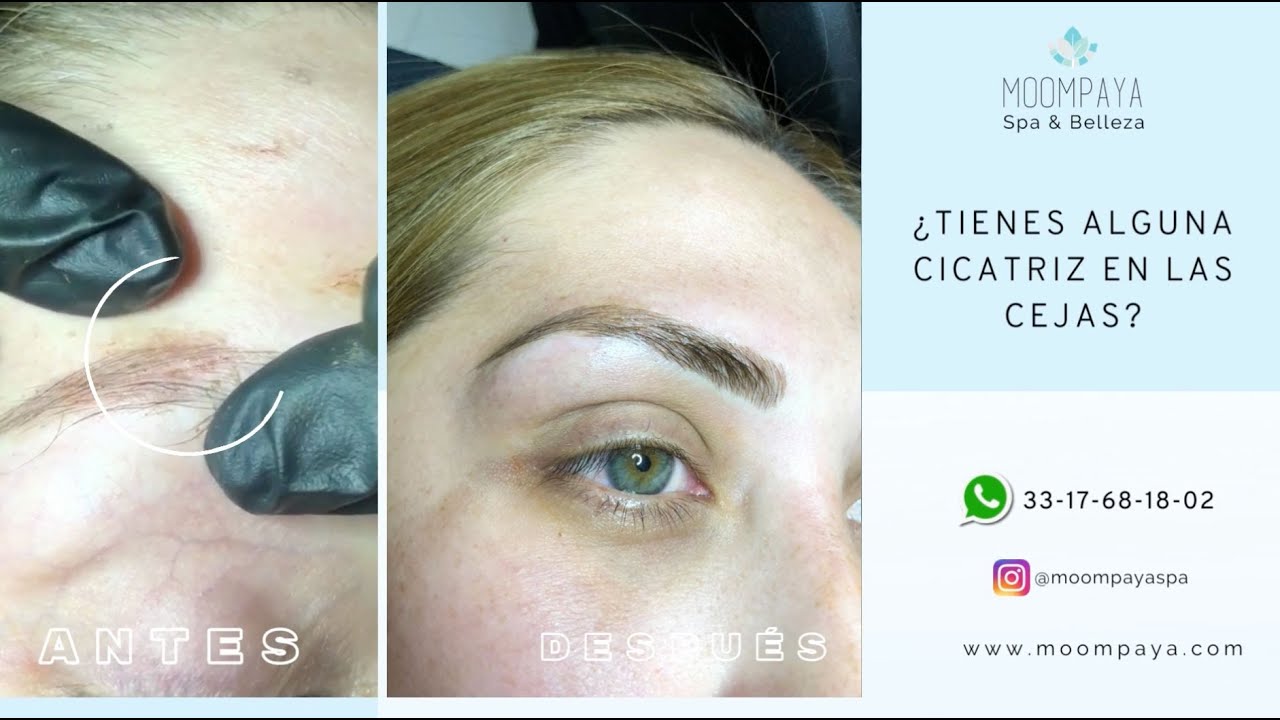 Microblading de Cejas en Guadalajara | Como Ocultar Cicatriz en las