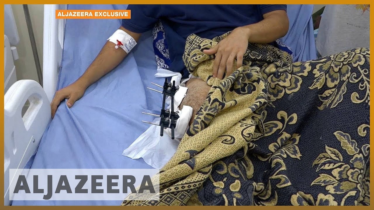 أزمة فنزويلا: عشرات الجرحى في أعمال عنف قرب الحدود | الجزيرة الإنجليزية