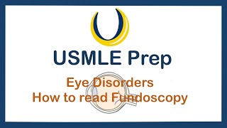 Details Disorders of the Retina- USMLE First Aid Follow Along (Ophthalmology) Update