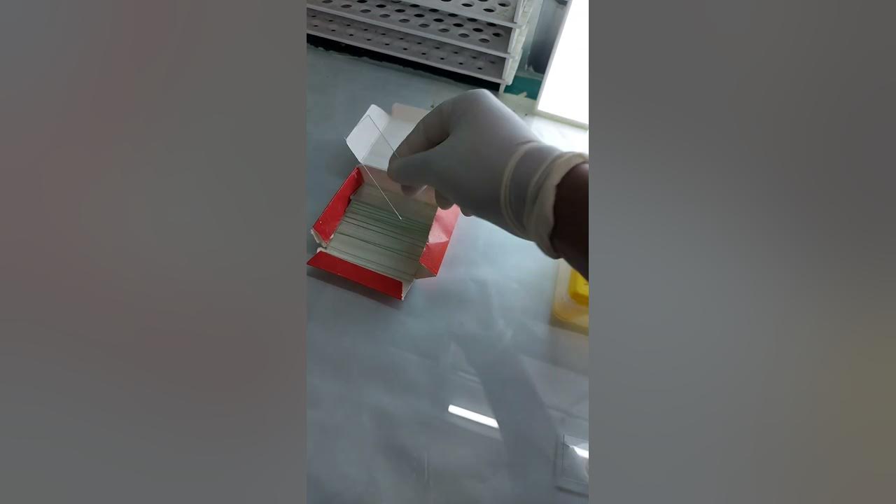 Agglutination of Blood Under Microscope 💉🩸🔬 YouTube