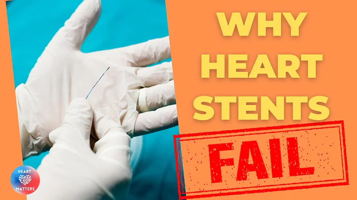 WHY heart stents FAIL? - DayDayNews