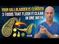 YOUR GALLBLADDER IS CLOGGED! 3 FOODS THAT FLUSH IT CLEAN IN ONE WEEK
