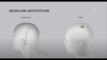 Neuralink: Elon Musk