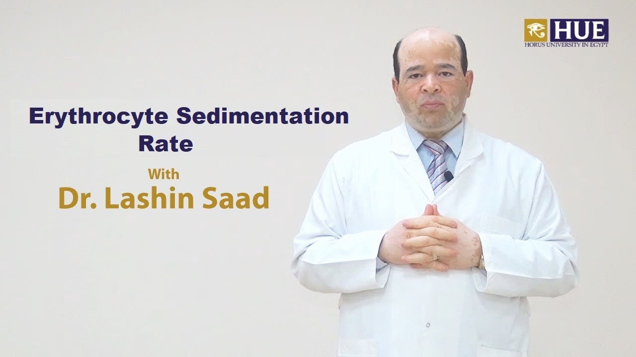 Erythrocyte Sedimentation Rate (ESR)  - by: Dr. Lashin Saad,M.D