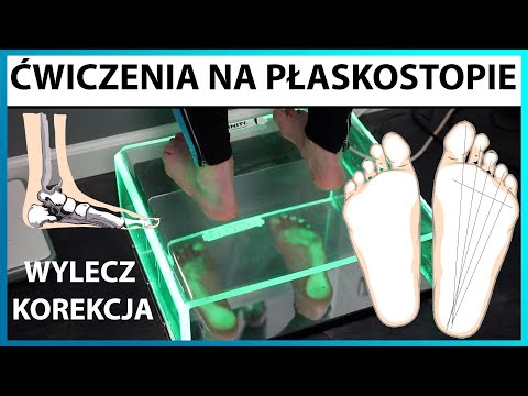 Ćwiczenia na płaskostopie 👣 KOREKCJA STOPY PŁASKIEJ, wylecz wadę postawy TRENING MEDYCZNY