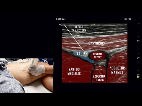 ultrasound-guided-adductor-canal-block-//-anatomy-review
