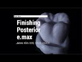 CEREC Posterior e.max Sculpturing and Finishing Steps