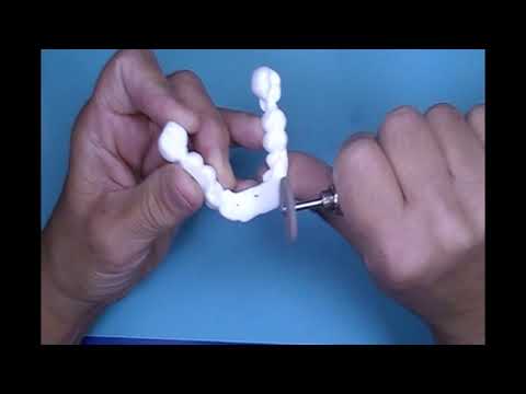 Adjusting Contacts Nylon Splint Video