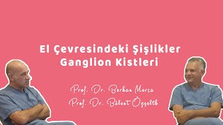 El Çevresi̇ndeki̇ Şi̇şli̇kler Ganglion Kistleri - Prof. Dr. Berkan Mersa Prof. Dr. Bülent Özçelik